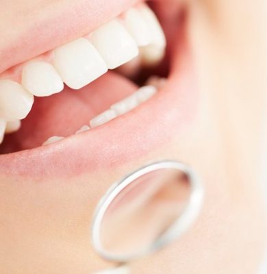 viva seguro sempre | Plano Dental: 5 razões Para ter um Seguro Odontológico